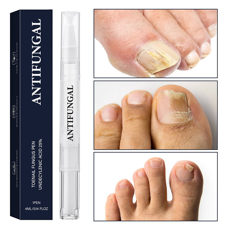 Nail repair pen