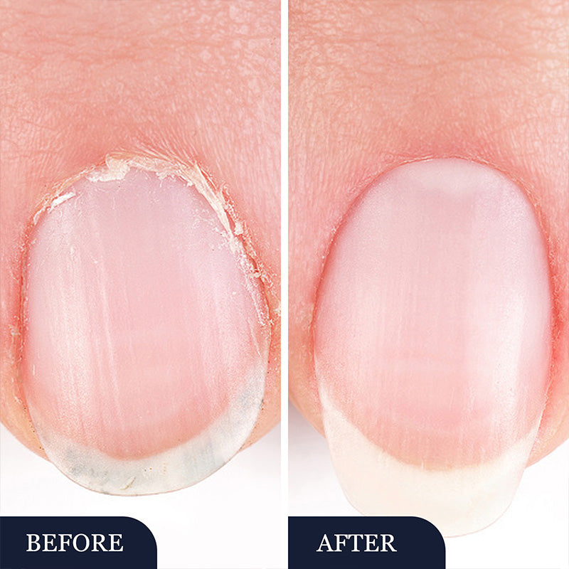 Nail repair pen