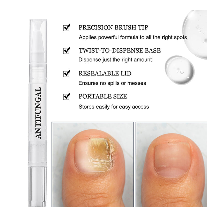 Nail repair pen